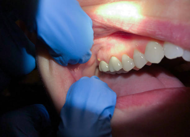 Best Pediatric Emergency Dentist in Bridge City, LA