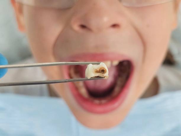 Best After-Hours Emergency Dentist in Bridge City, LA